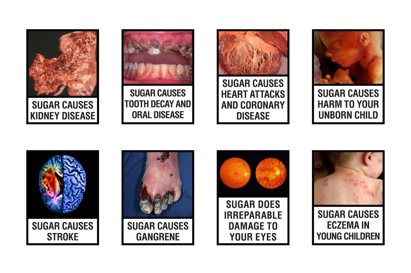 Cigarette Box Warnings (secondary activation): &quot;1 Every 6 Seconds&quot; - Diabetes Association of Sri Lanka, World Diabetes Day 2014